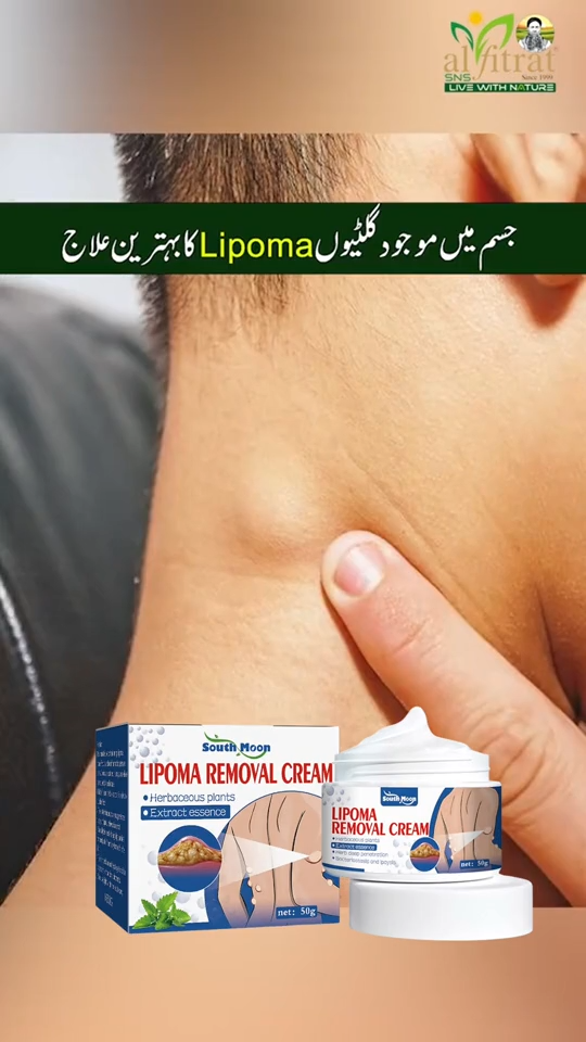 Lipoma Removal Cream | Non-Surgical Lipoma Remover Cream