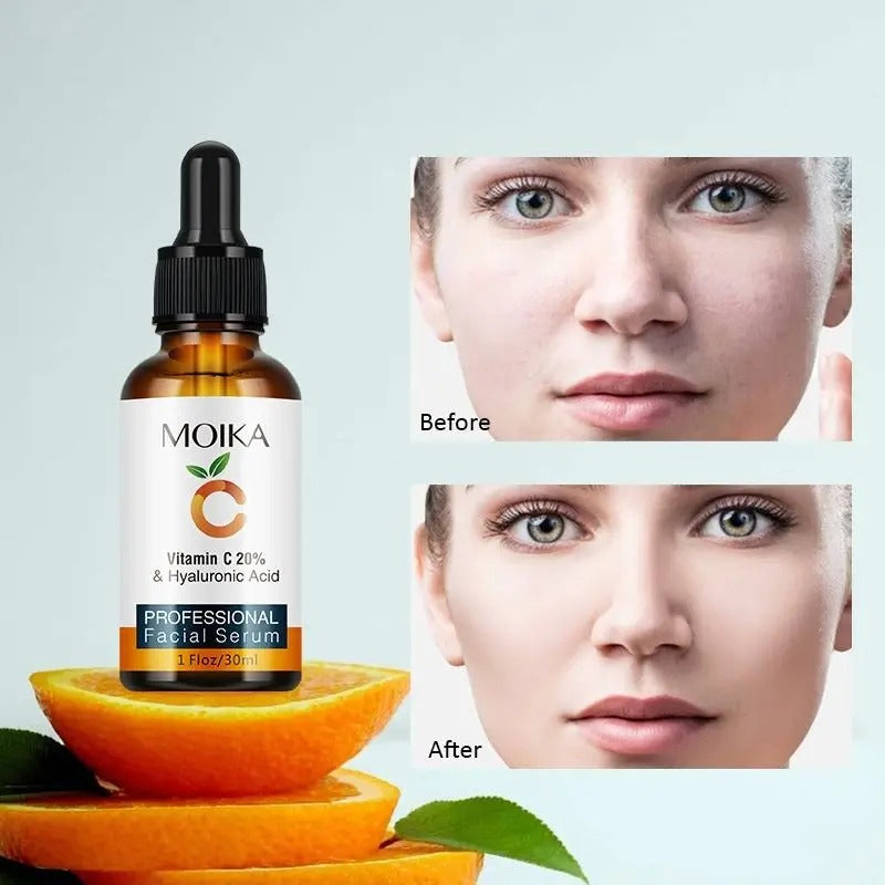 Vitamin-C Serum | Brightening & Anti-Aging Face Serum